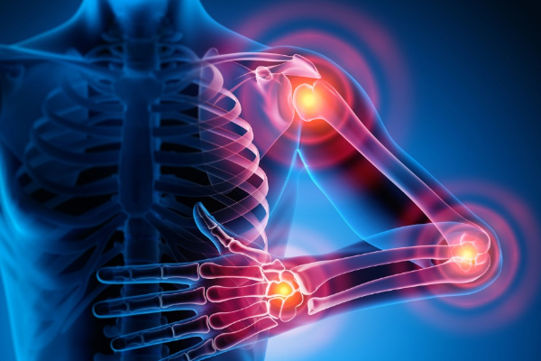 Rheumatology